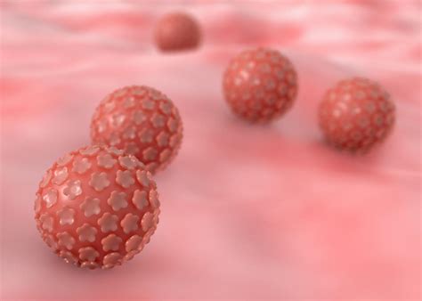 Virus del papiloma humano (VPH): Tratamiento, síntomas y causas