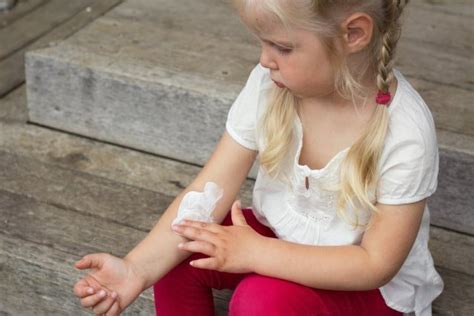 Питание, уход за кожей при атопическом дерматите у детей | MedAboutMe