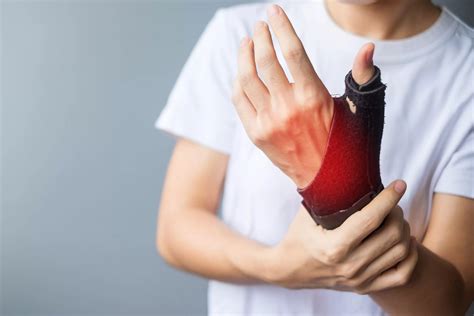 Pain Management Guide for Your Soft Tissue Injury - PMIR