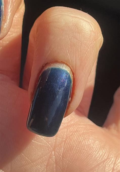 fingernail infection . on accutane : r/Accutane
