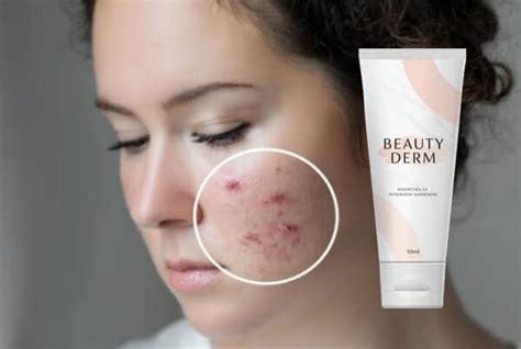 Beauty Derm крем Мнения - Как се използва и Ефект?