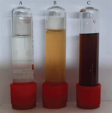 (A) Aqueous silver nitrate solution, (B) aqueous extract of Strychnos ...