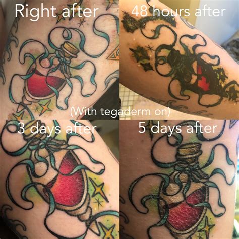 Aftercare — Foxwood Tattoo Collective