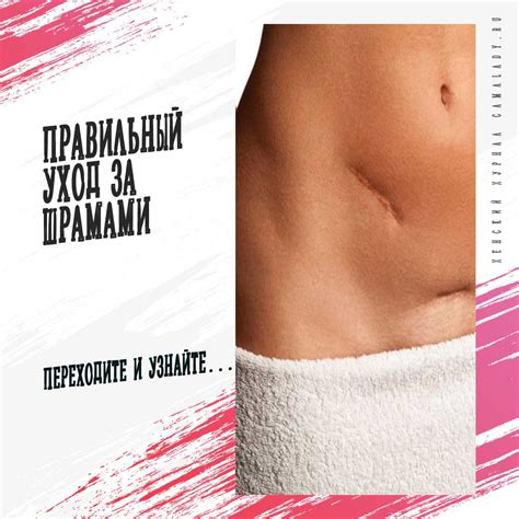 Правильный уход за шрамами