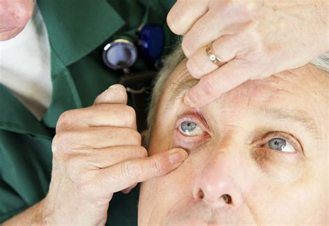 Emergency Eye Care Services | House of Optical