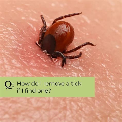 Tick Smart Tips for Staying Safe While You're Out and About | Ticks