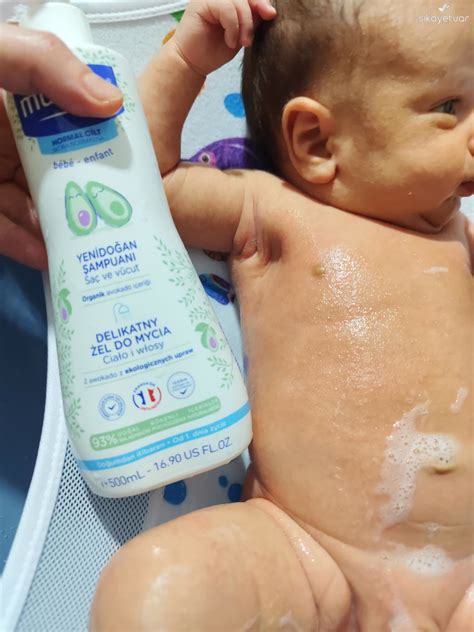 I Used Mustela Baby Shampoo and It Caused Severe Allergic Reactions