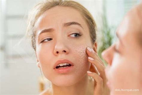 inilah   mengatasi kulit kering  bahan alami