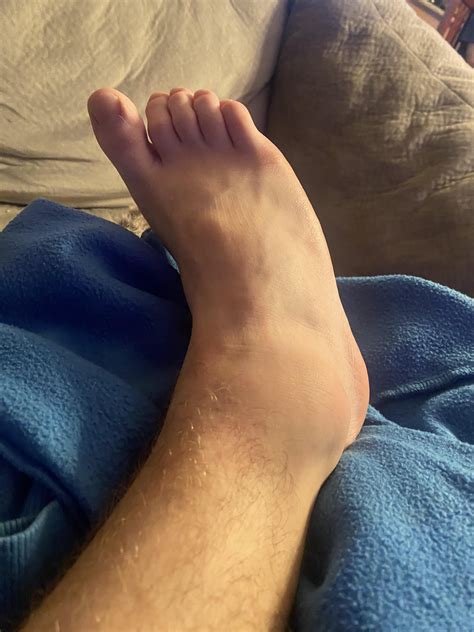 Sprained my ankle yesterday : r/NewSkaters