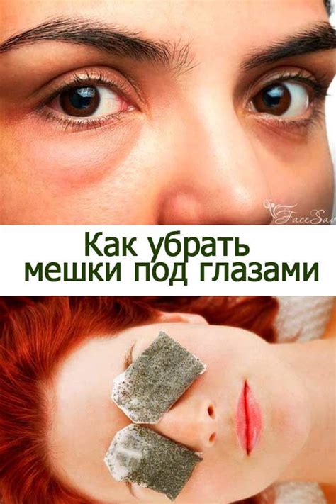 Почему появляются мешки под глазами и как их быстро убрать в домашних ...