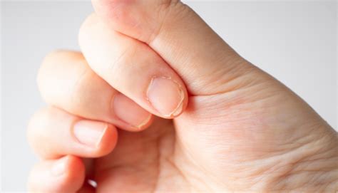 Unhas Quebradiças O Que Pode Ser - Unhas quebradiças, o que pode ser? 7 causas comuns e o que fazer