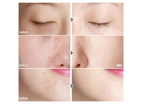 Атоми ББ крем - сияйте естественной красотой с Atomy BB Cream!