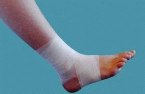 Повязки для лечения трофических язв на ногах: типы и применение