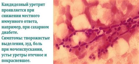 Мужская уретра: строение, симптомы, лечение и профилактика