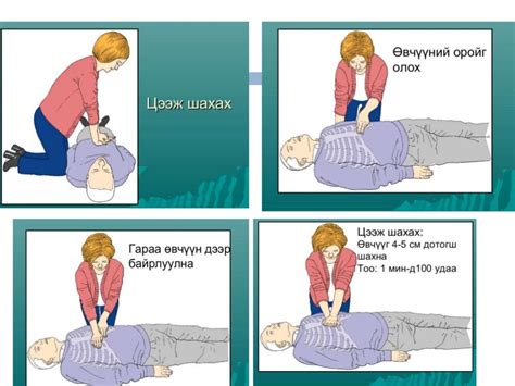 амилуулах суурь тусламж, лавшруулах тусламж