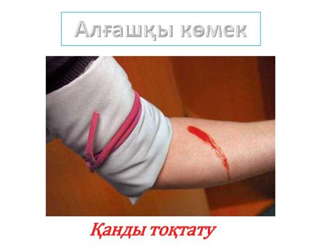Геморрагиялық шок - презентация онлайн