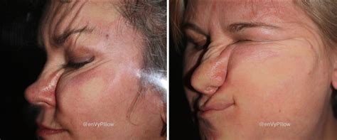 Sleeping on Your Face Ages You | enVy Pillow