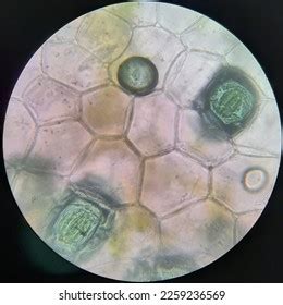 epidermal cells  microscope