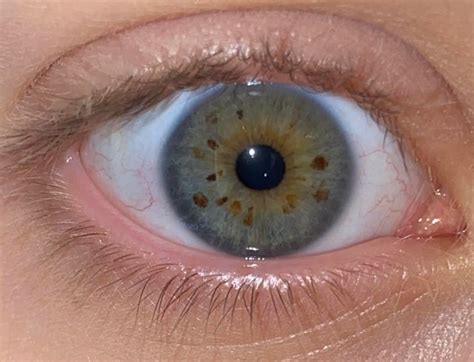brown|green heterochromia. : heterochromia