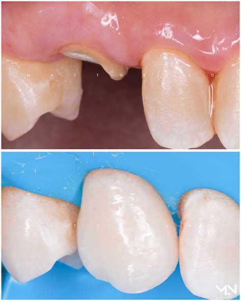 Los Angeles Biomimetic Dentistry | Beverly Hills, West Hollywood