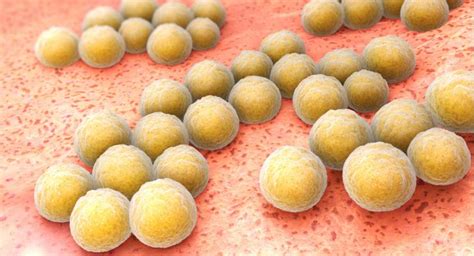 probiotic reduces  aureus colonization  phase  trial