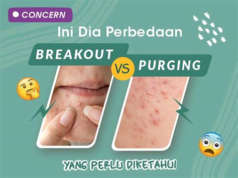 perbedaan breakout  purging youtube riset
