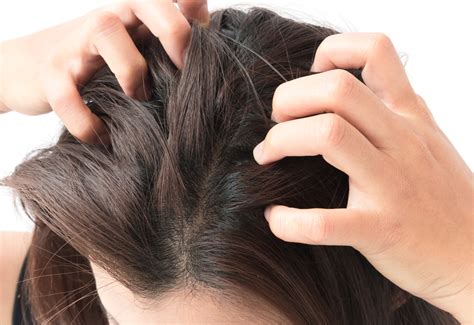 Лечение грибка волосистой части головы в Одессе в медицинском центре Dr ...