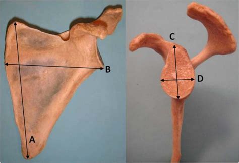 left scapula posterior view