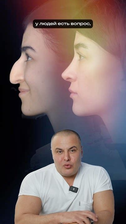 Удачная ринопластика - Кавказский нос #drmuradov - YouTube