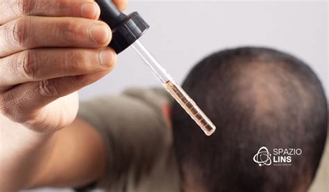 Quanto Tempo Para O Minoxidil Fazer Efeito - Quanto Tempo Leva para o Minoxidil Fazer Efeito? - Spazio Lins