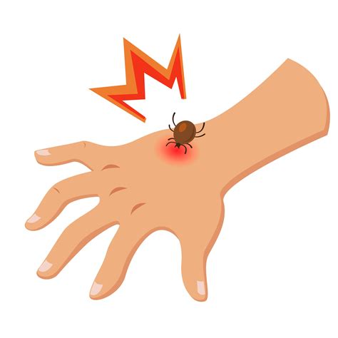 5 Misconceptions About Tick Bites and Lyme Disease - Charlotte Parent