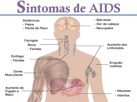 Sintomas De Aids Em Mulher - 8