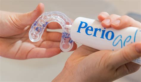 Perio Protect® - Official, Authorized Distributor | Curion Canada – Curion Dental Products