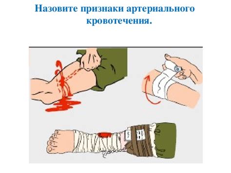 Презентация "Виды ран"