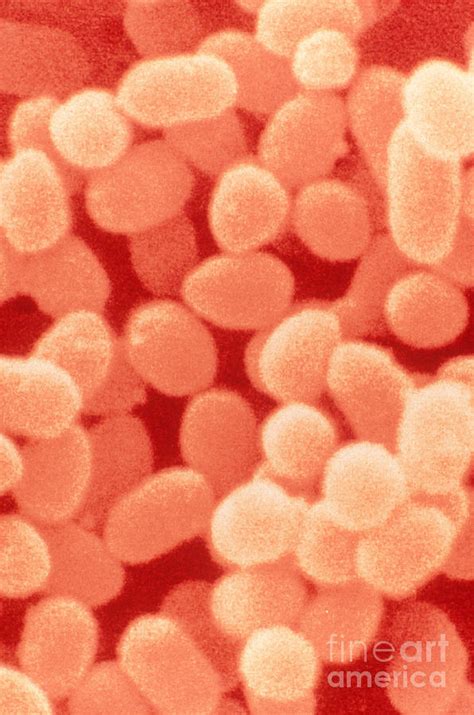 serratia marcescens sem photograph  scimat fine art america