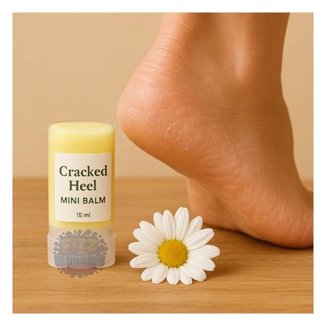 Cracked Heel Mini Balm – Fizz and Bubbles