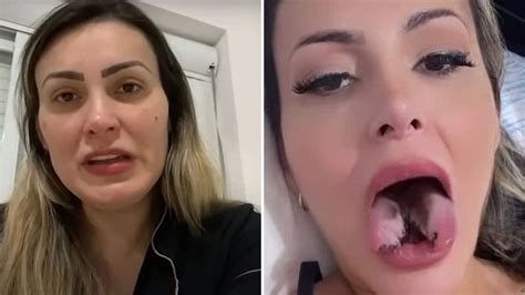 Andressa Urach: veja quais são os riscos de fazer bifurcação da língua ...