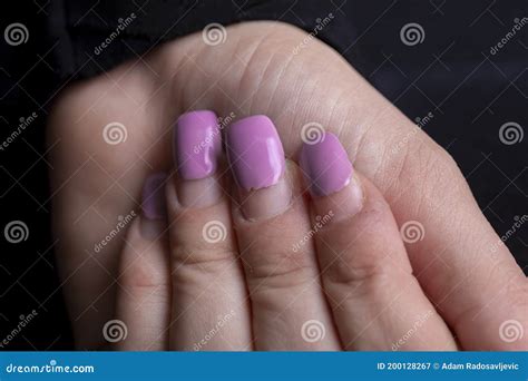 Overgrown Gel Polish Nails Manicure. Female Hands with Overgrown Nail ...