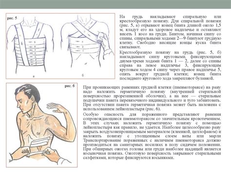 Правила наложения стерильных повязок на голову и грудь. Правила ...