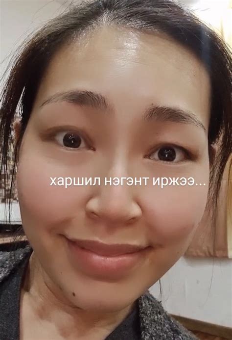 Хөтлөгч Э.Уянга харшилтайгаа тэмцэнэ – ТАС.МН