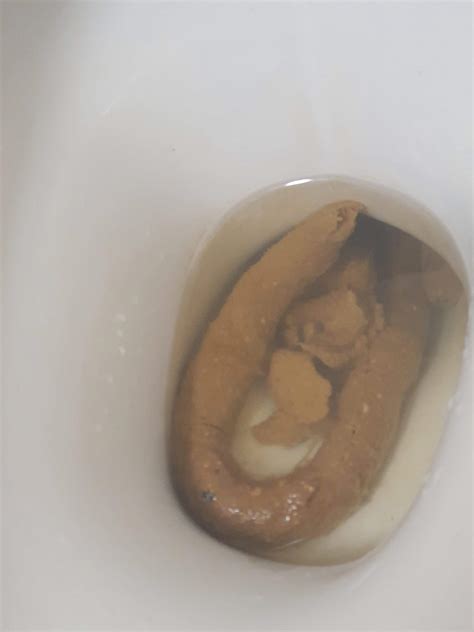 longest poop ever recorded 1