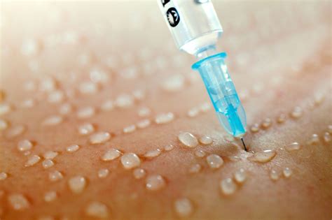 Mesotherapie – Dr. Kipp