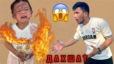 😱 Ё Аллохим. Кичкина Кизча Тириклайин Ёниб Кетди. Лекин Мужиза булиб ...