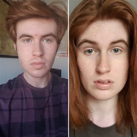 Hrt face changes : r/asktransgender