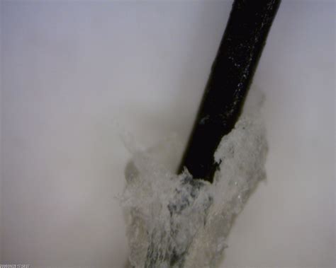 Trichoscopy, Hair
