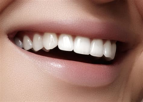 kinds  teeth shapes design talk