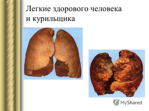 Презентация на тему: "О вреде курения. «Почему курить вредно ...