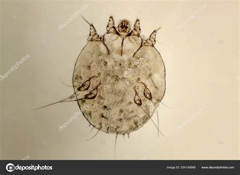 human skin parasites pictures picture  parasitic skin diseases