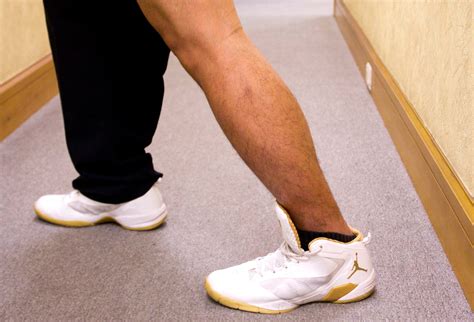 What Are Achilles Tendonitis And How To Fix Them Achilles Tendon