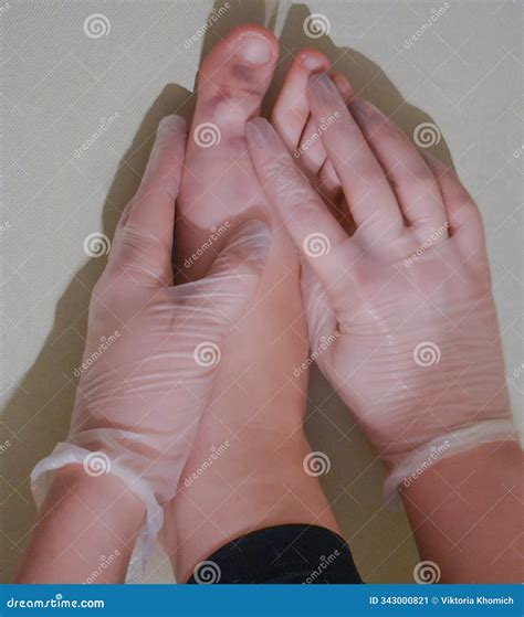 There is a Bruise on the Big Toe, a Fracture, a Sprain with a Purple